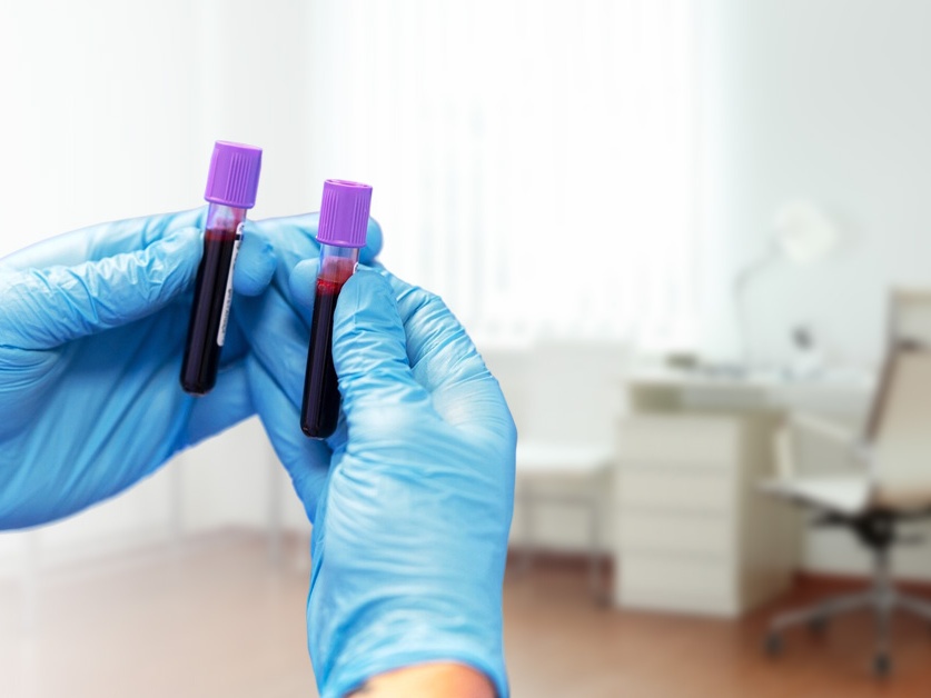 Odběrová ambulance (odborná ordinace Oblastní nemocnice Mladá Boleslav a.s.)