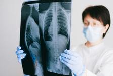 Nové vyšetření v Hradišti: odhalí riziko zlomenin kvůli zákeřné osteoporóze